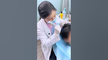 Bí Mật Điều Trị RỤNG TÓC TỰ MIỄN ( Rụng Tóc Mảng)  KHÔNG DÙNG THUỐC (P3) #tóc #rụngtóc #moctoc