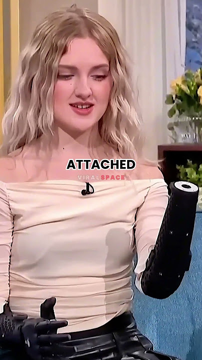 Bionic Arm Real-Life Demo