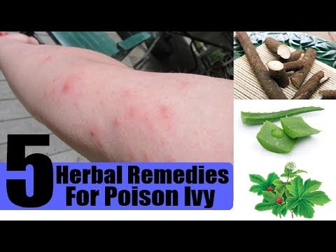 5 Home Remedies for Poison Ivy | By Top 5.