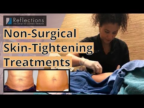 【極美品】Non-Surgical Skin Tightening and Li Before & After Photos Subdermal Skin Tightening - PP Jplasma