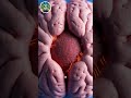 What Happens During Tumour Removal?