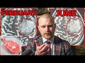 Brain Tumour Update - MRI Results After Strict Keto, Fasting &amp; Chemo | Does This Work?