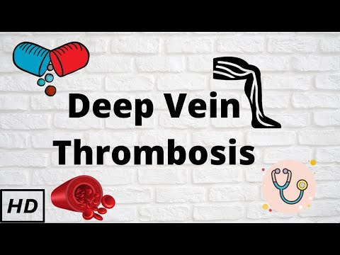 Video: Deep Vein Thrombosis Of The Lower Extremities - Symptoms And Treatment