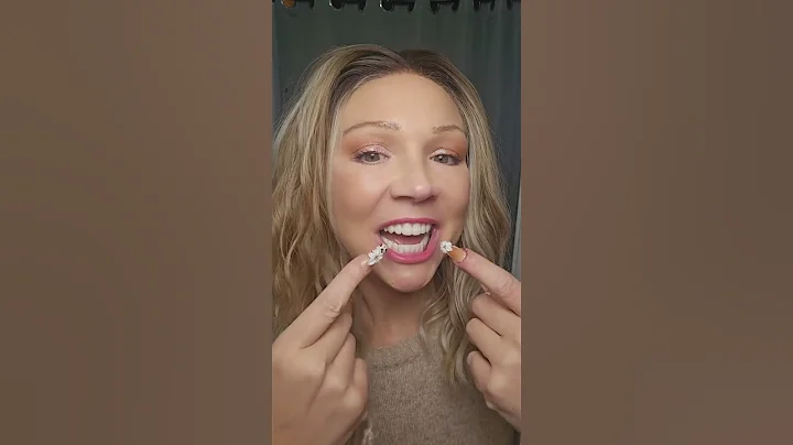 ZIRCONIA FINALS...HERE I COME! 🦷🫶 #zirconiateeth #allon4 #allon4dentalimplants #dentalimplant #teeth