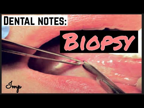 BIOPSY II ORAL PATHOLOGY AND ORAL SURGERY II imp