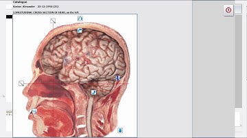 Bioresonance Classes and Certifications Biophilia 4D and Metapathia running  on 1 laptop