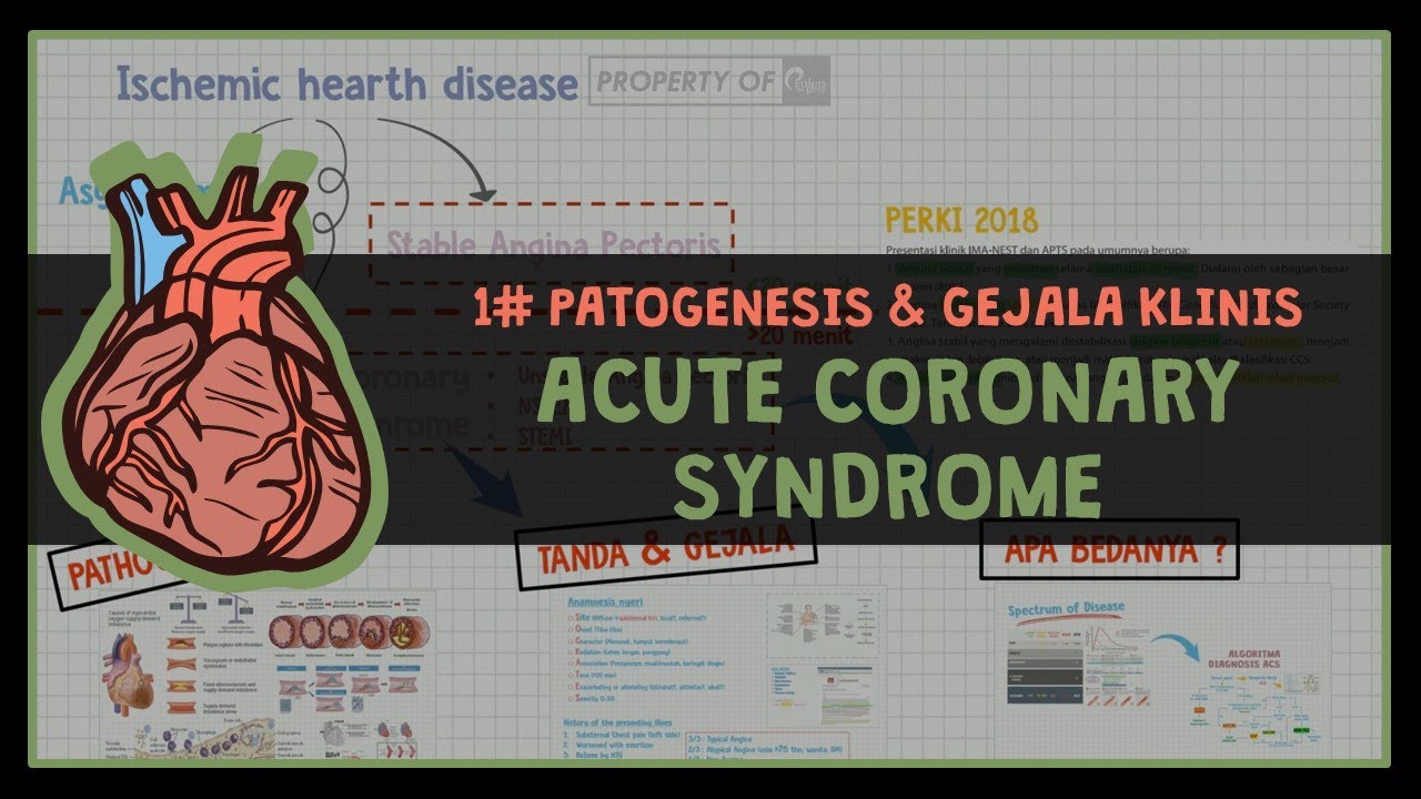 PENYAKIT JANTUNG KORONER ?? INI PENJELASAN PENYAKIT SINDROM KORONER AKUT #1 ACUTE CORONARY SYNDROME