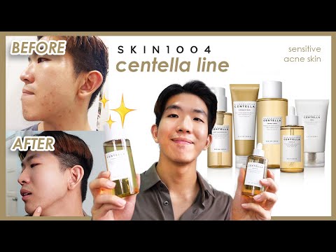 روتین مراقبت از پوست مورد علاقه من با Skin1004 Centella! | بافت پوست براق