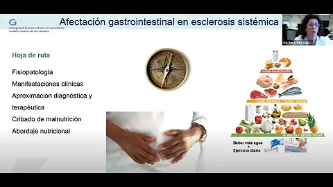 ¿Cómo afecta la esclerodermia a los intestinos?