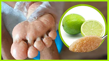 ¿Cómo se limpian los pies con limón?