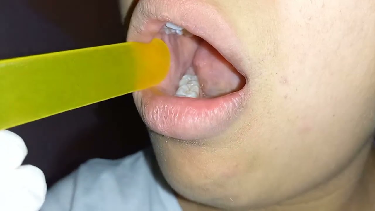 Examen bucal - salud bucal.