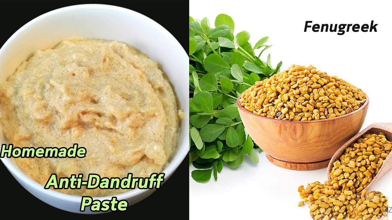 How to Get Rid of Dandruff  Homemade  Natural Treatment  Miracle Cure For Dandruff