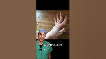 Got swan necks? #Swan #Deformity #Hypermobility #Hand #MedicalStudent #Laxity #EhlersDanlos #Dr