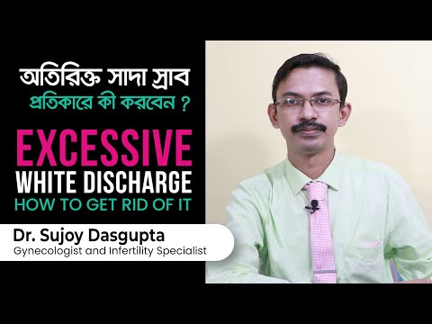 ভিডিও: মাকড়সা ঝাড়বাতি (36 টি ছবি): অভ্যন্তরে একটি মাকড়সার আকারে সাদা এবং রঙিন সিলিং মডেল