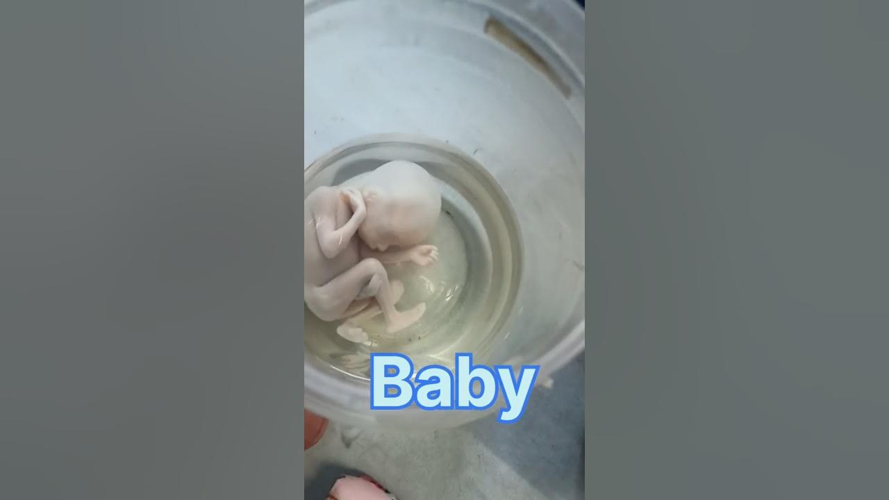 baby-shorts-baby-in-anatomy-lab-human-heart-human-lungs-human