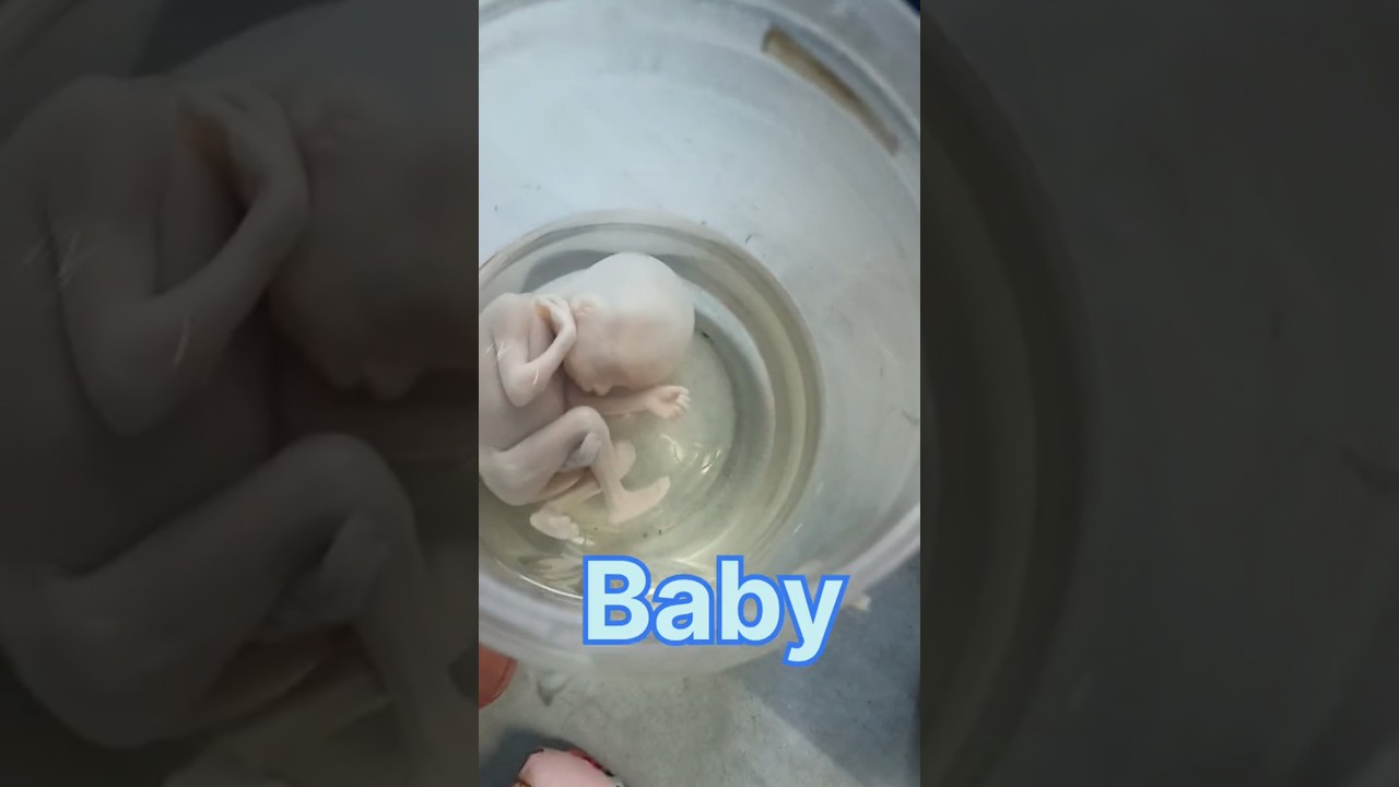 Baby Shorts Baby In Anatomy Lab Human Heart Human Lungs Human Baby Shorts Baby In Anatomy Lab Human Heart Human Lungs Human