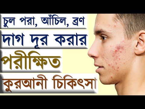 ভিডিও: বোরন কি চুল পড়ার কারণ?