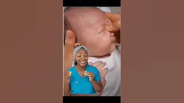 Doctor explains crigler massage to help crusted eyes in babies #blockedtearduct #newborns
