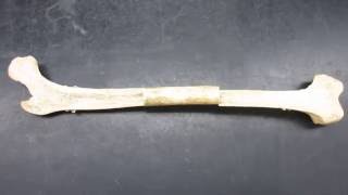 Anatomy of a long bone