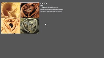 ClinicalKey Overview