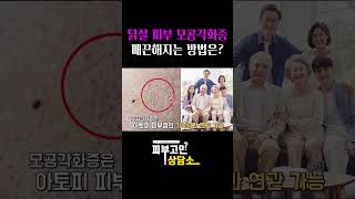 [1분진료실] 닭살 모공각화증 부드럽게 만드는 방법은?? #shorts