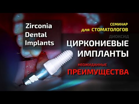 Циркониевые импланты ПРЕИМУЩЕСТВА Титан или керамика ВИДЕО для СТОМАТОЛОГИИ Zirconia Dental Implants