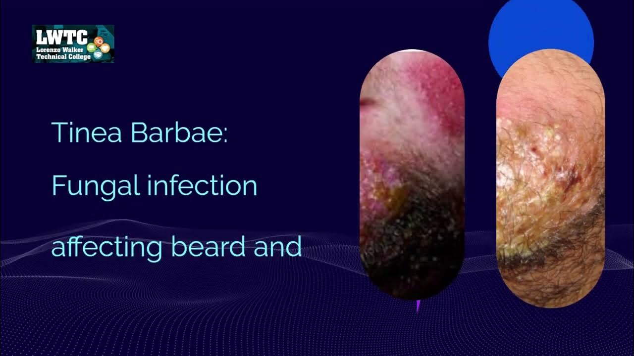 Chapter 08 Hair and Scalp Diseases and Disorders, Scalp Diseases Every