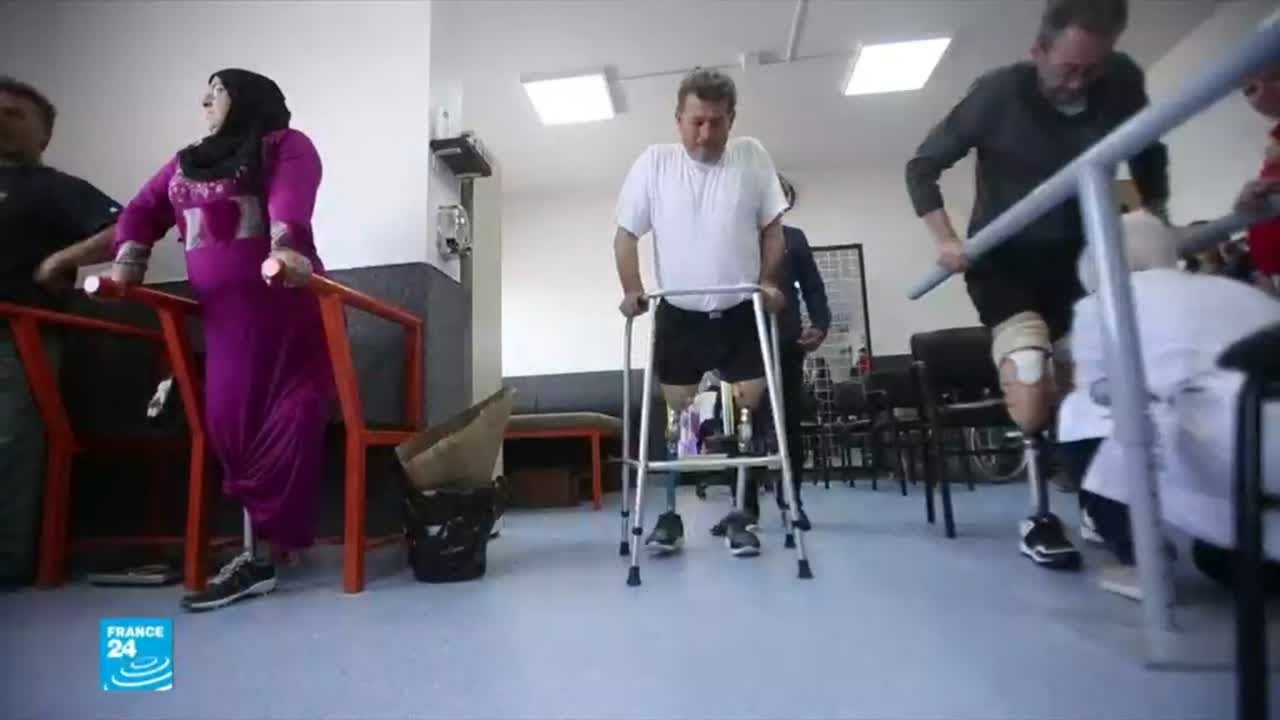 أول مركز في سوريا لصناعة الأطراف الصناعية يساعد مصابي الحرب