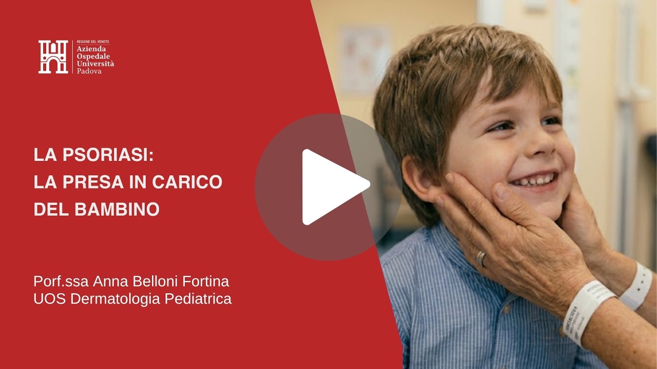 La psoriasi: la presa in carico del bambino