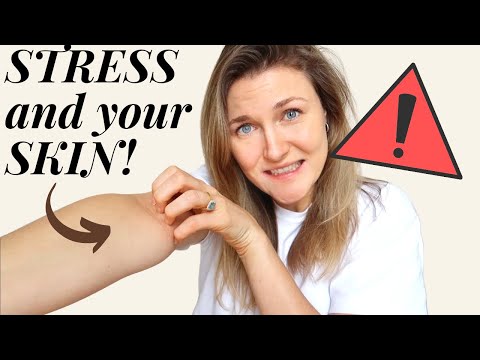 How STRESS affects