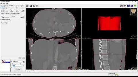 Analyze 14.0 - Segment: Threshold Based Segmentation