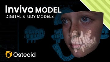 Invivo Model Digital Study Models