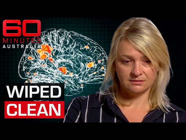 The common virus that can wipe away your memories | 60 Minutes Australia class=