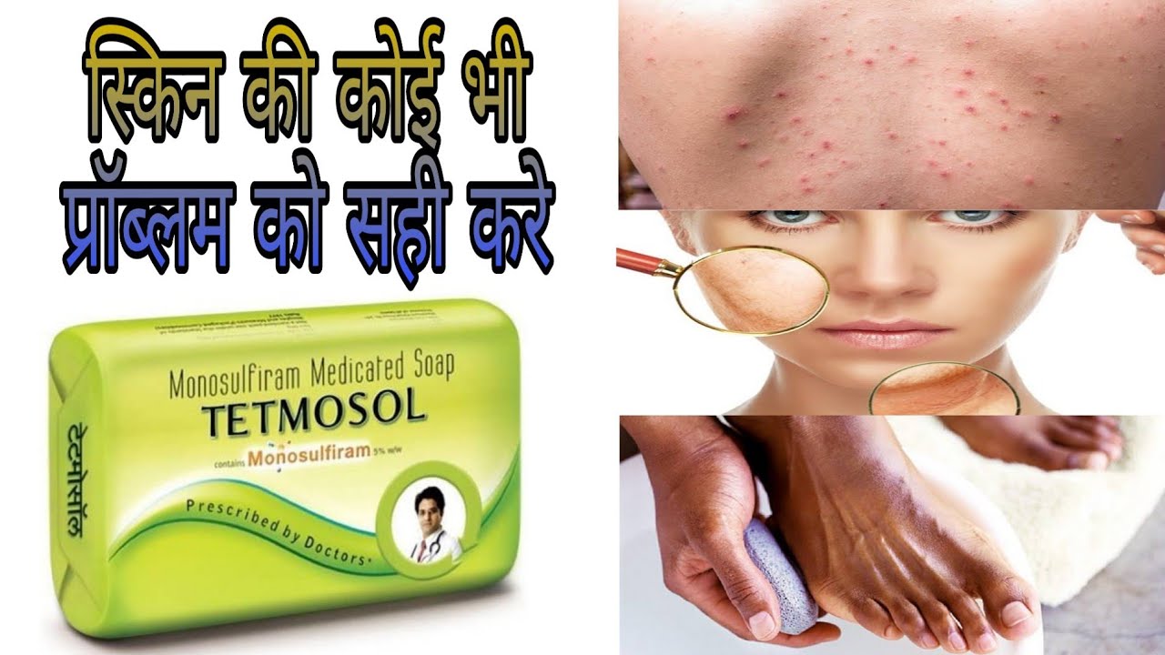 Tetmosol Soap Use In Hindi Tetmosol Soap Use In Hindi