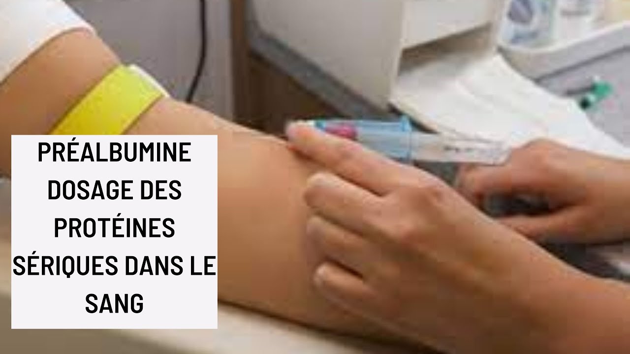 Préalbumine, Dosage des protéines sériques dans le sang