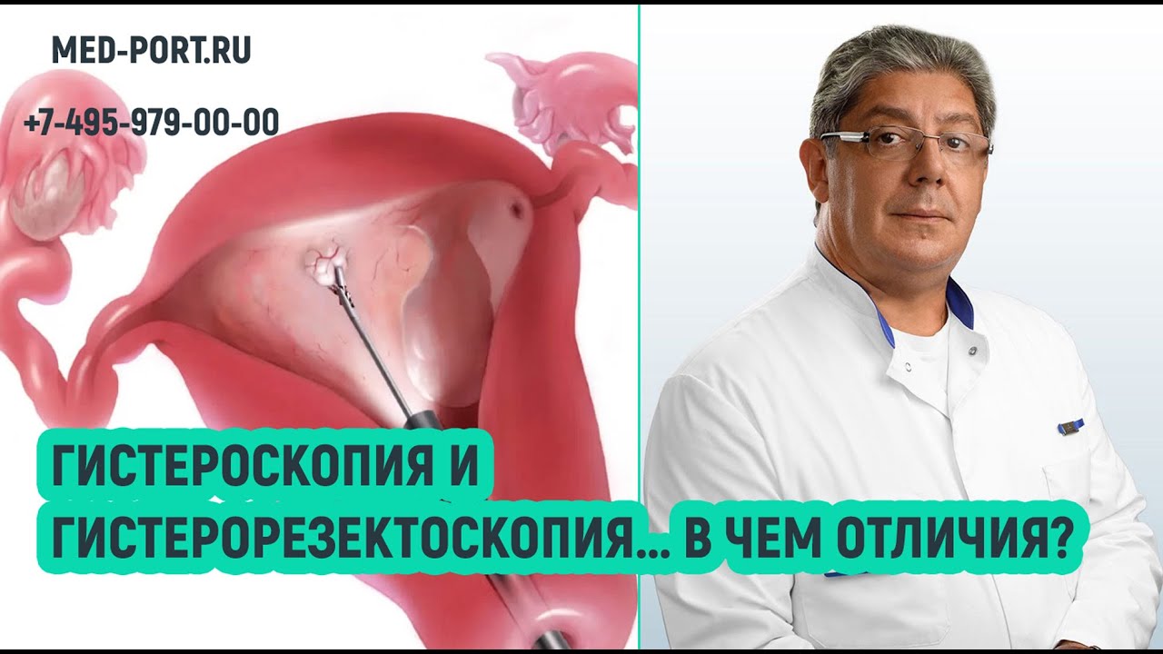 Гистероскопия в Киеве ♻️ Обследование матки гистероскопия | Мед Сити