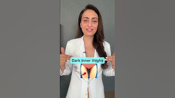 Dark inner thighs | causes and treatment | #dermatologist