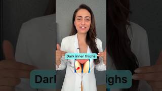 Dark inner thighs | causes and treatment | #dermatologist