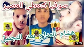 شوفو هشام المداح بعد  عملية التجميل