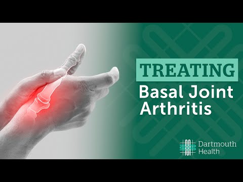 Video: Basal Joint Arthritis Symptomer Og Behandling