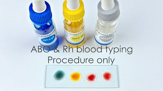 Abo Blood Grouping Test Procedure