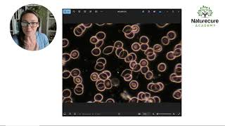 Do your clients have 'Leaky Gut'? Blood analysis holds the answers