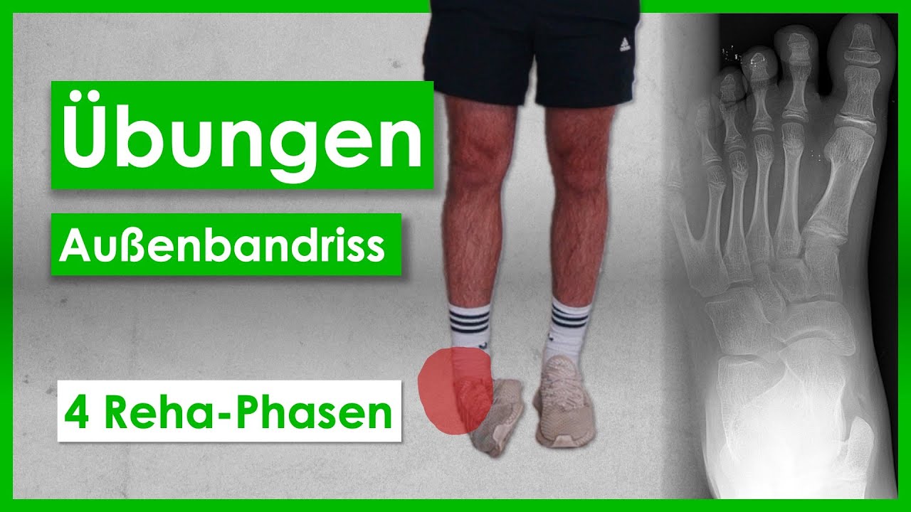 Erstaunlich Schiene Fur Banderriss Bilder