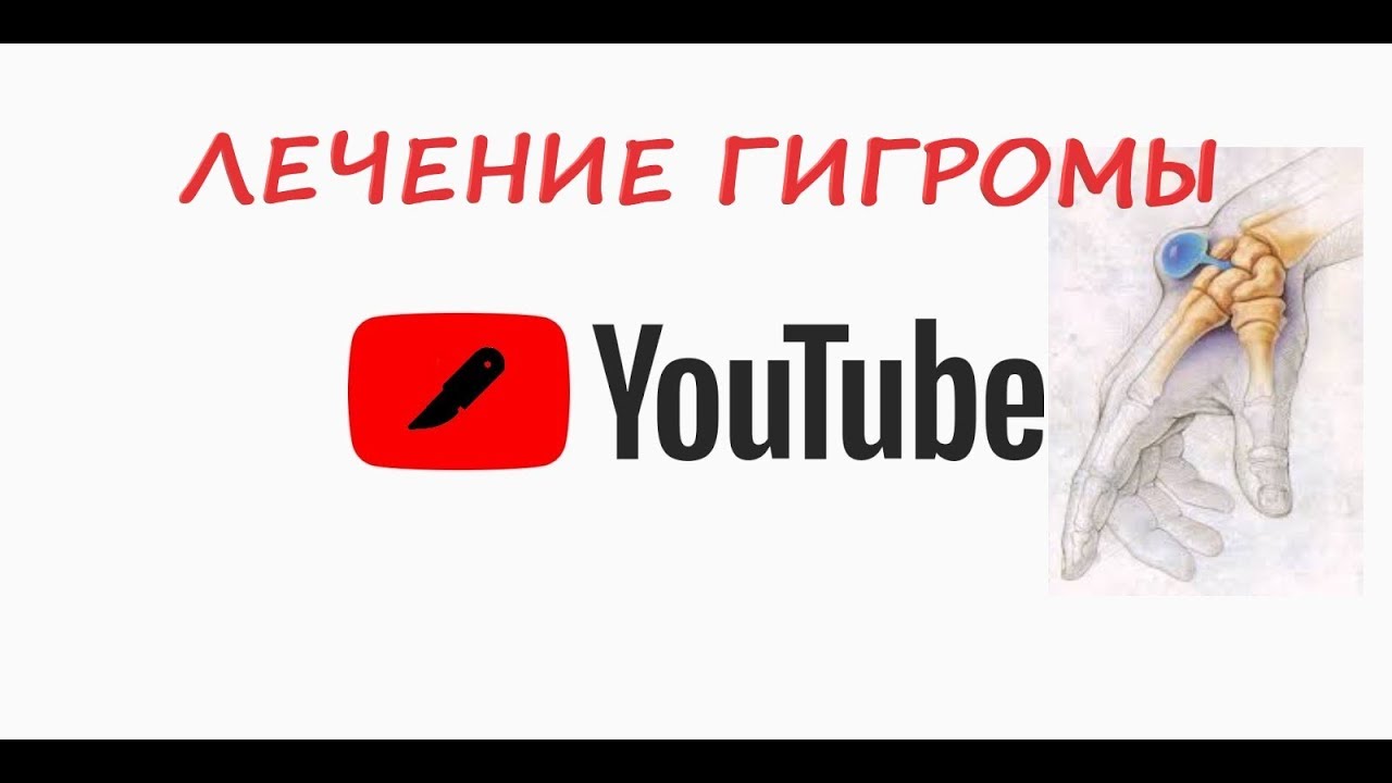 Оперативное лечение гигромы голеностопного сустава . Ход операции с ...