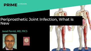 Periprosthetic Joint Infection, What is New - Javad Parvizi, MD, FRCS
