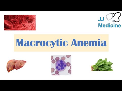 Video: Cum se tratează anemia macrocitară
