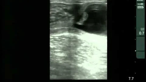 Cow #4539 Day 30 of Gestation