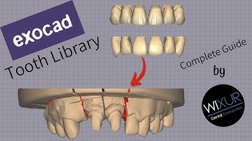 Exocad Tooth Library