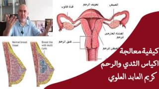 كيفية معالجة اكياس الثدي والرحم / الدكتوركريم عابد العلوي