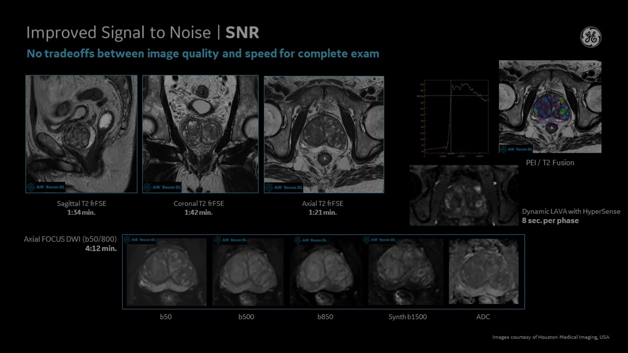 GE Healthcare Prostate MR Commercial